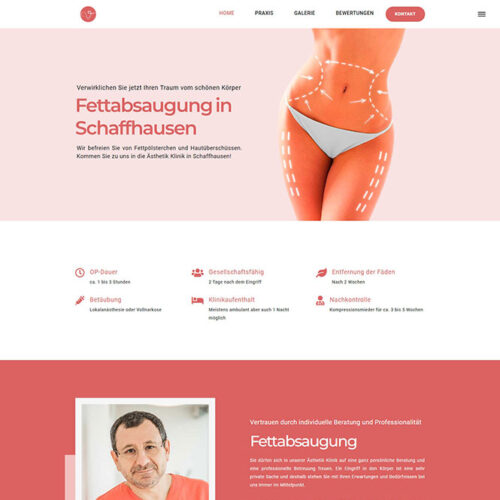 liposuction-schaffhausen.ch